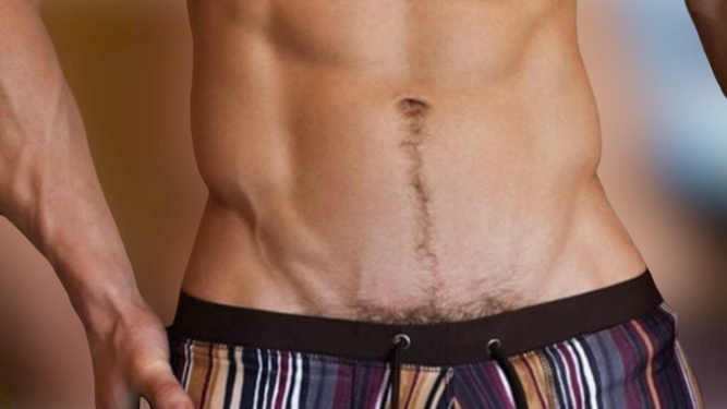 methode pour epiler son penis